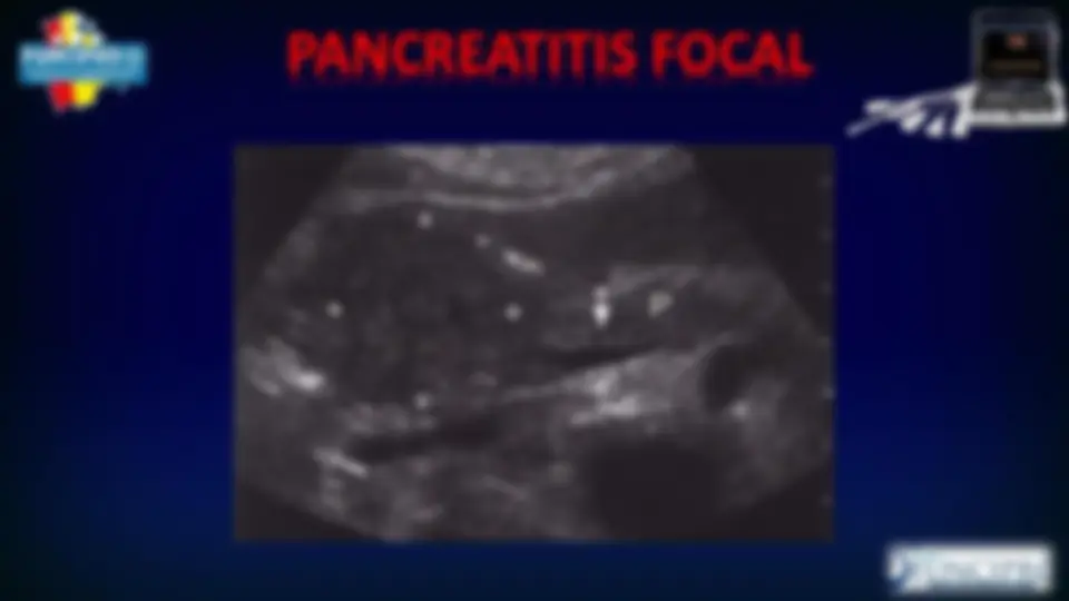 pf1a