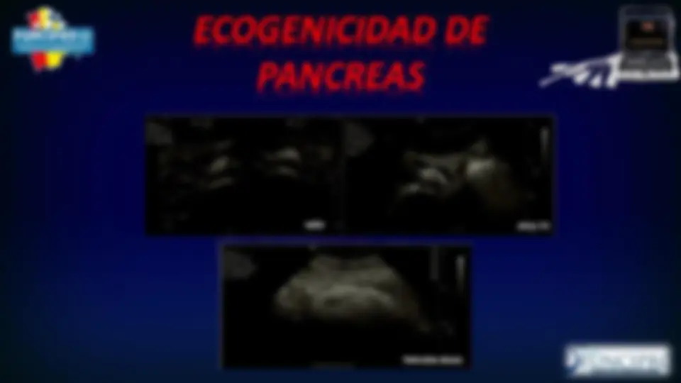 pfa