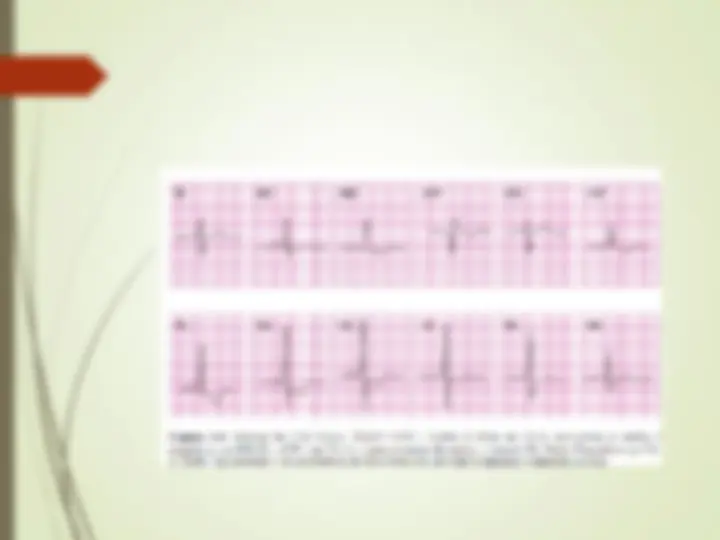 pf43