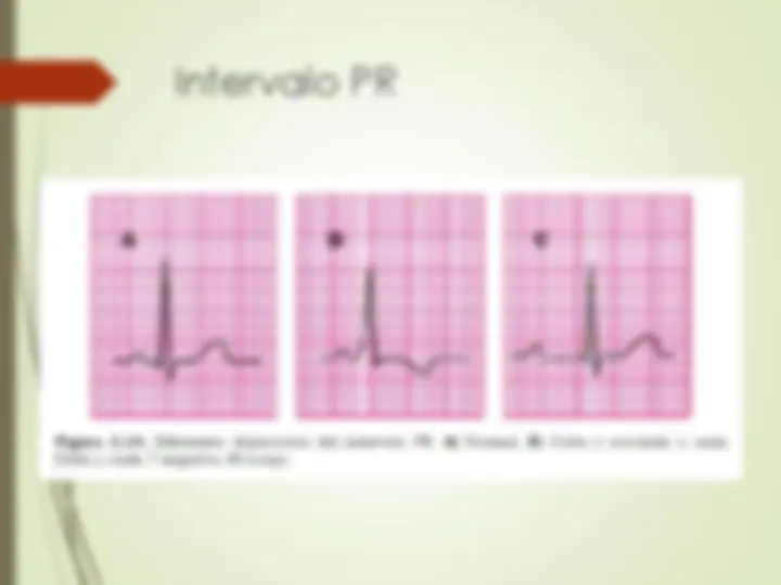 pf2a