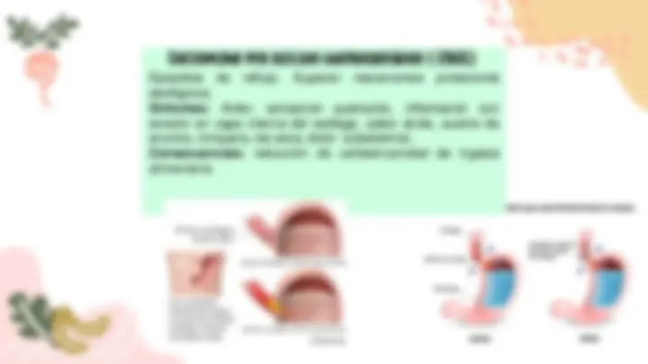 pfa