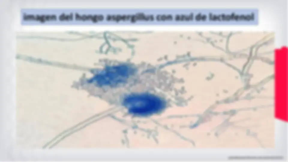 pfe