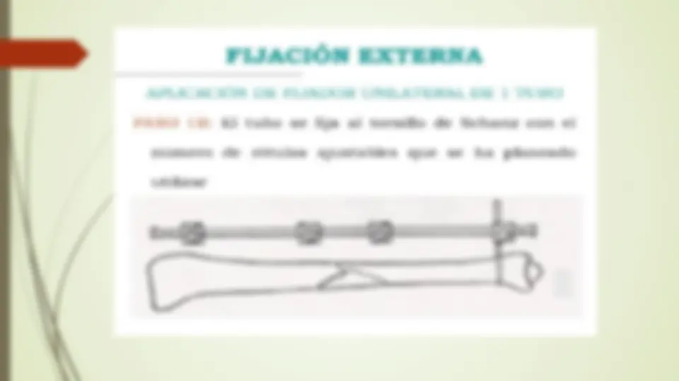 pf14