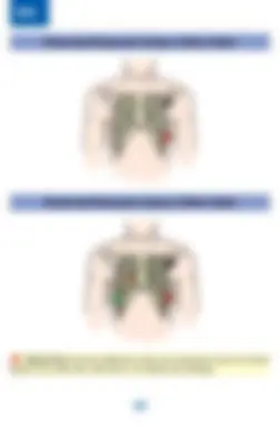 pf1a