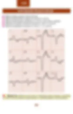 pf62