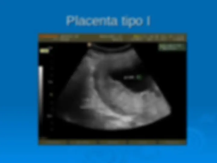 pf1a
