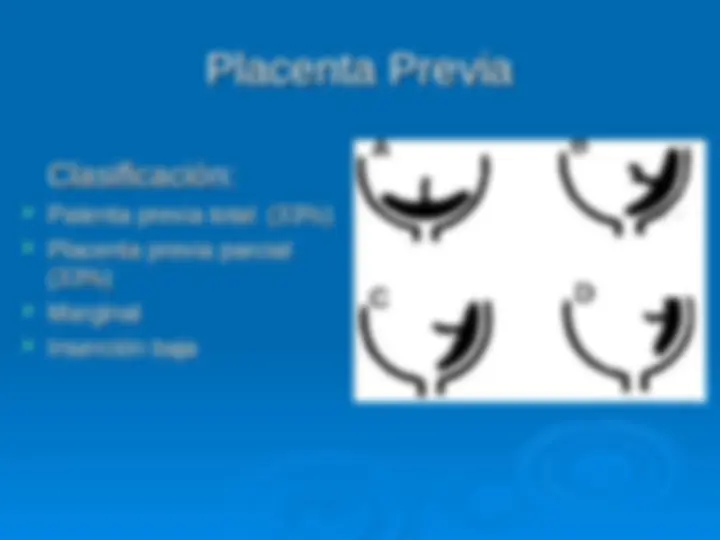 pf2a