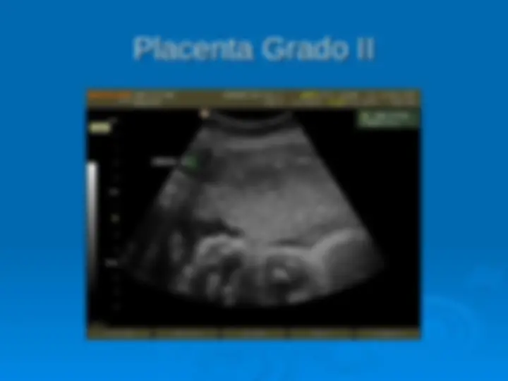 pf1c
