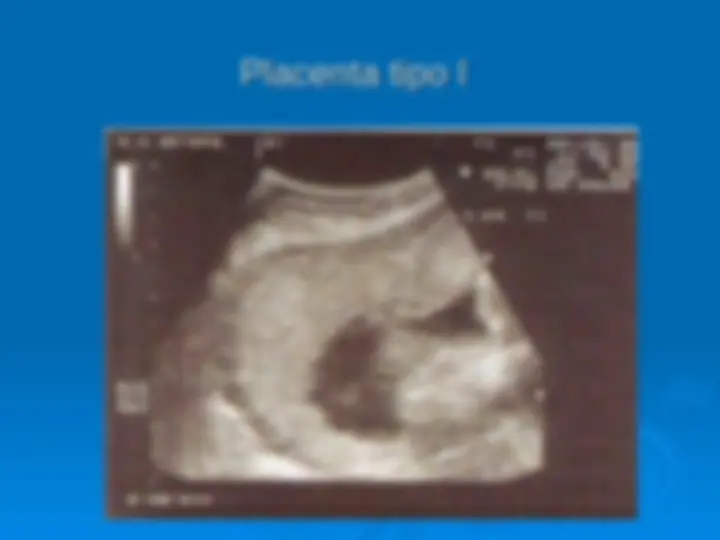 pf19