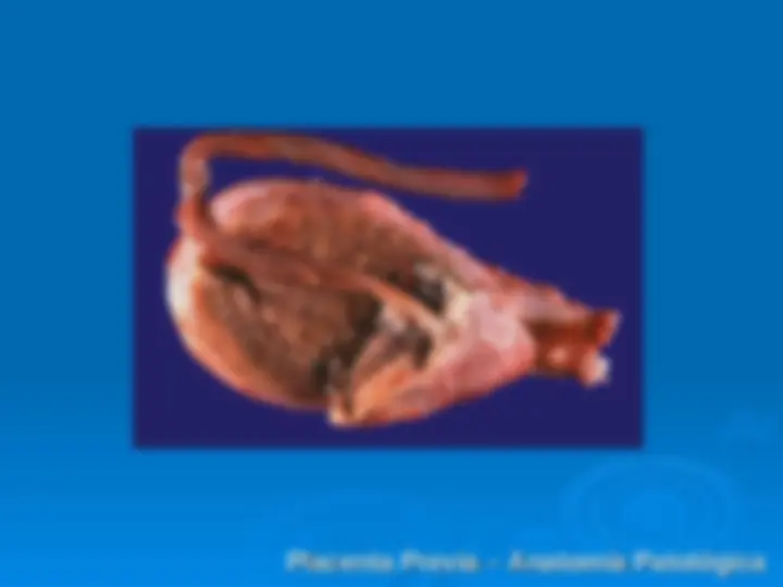 pf31