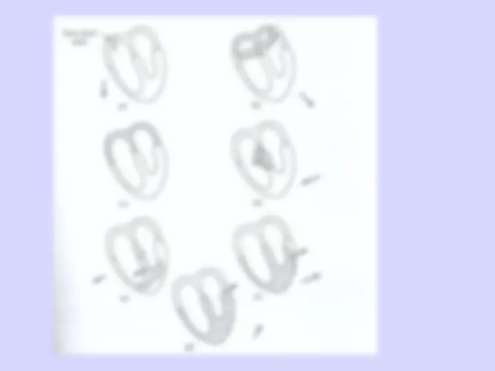 pf20