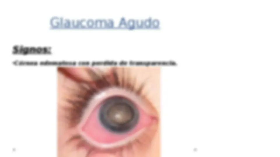 pf1d