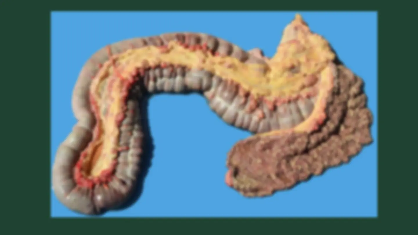 pf21