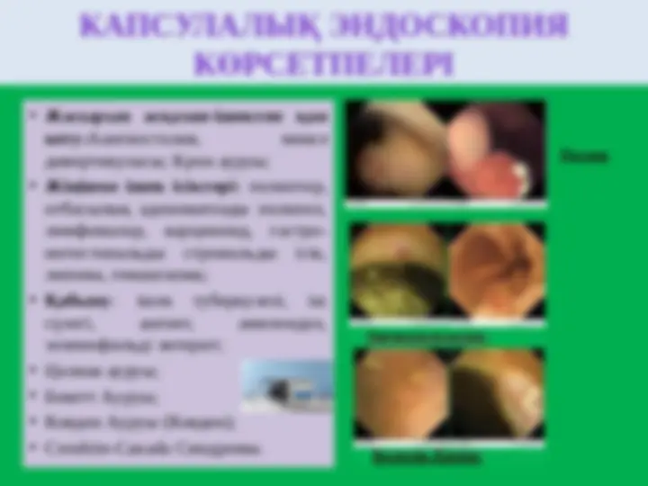 Pioneglager-дегі жалаңаш ванналар туралы порно әңгімелер Қара жігіт қыздың кискасын жұлып алады (порно)