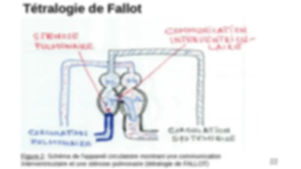 pf16