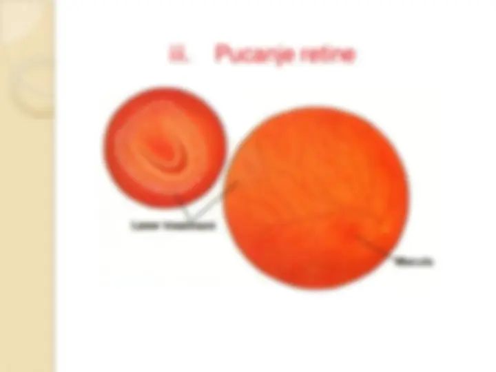 pf29