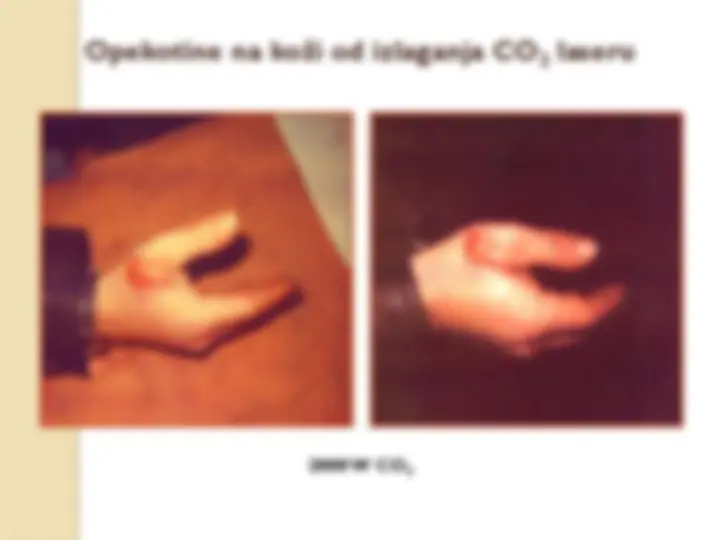 pff