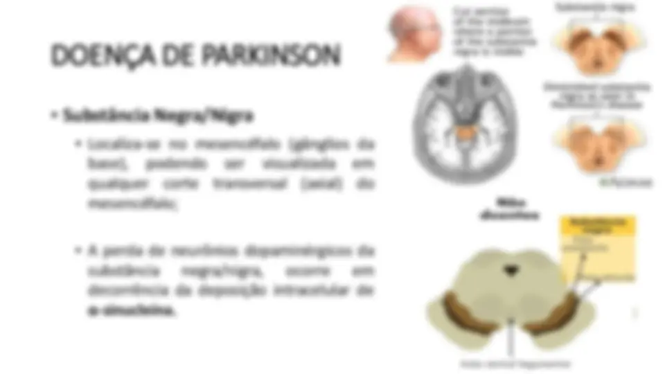 pfa