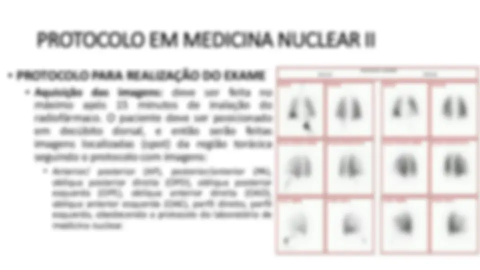 pfa