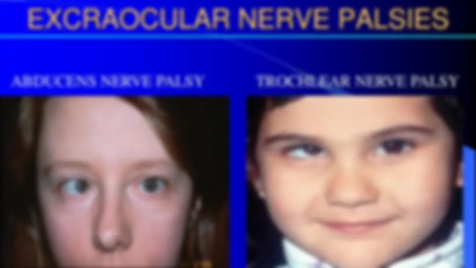 pf2d