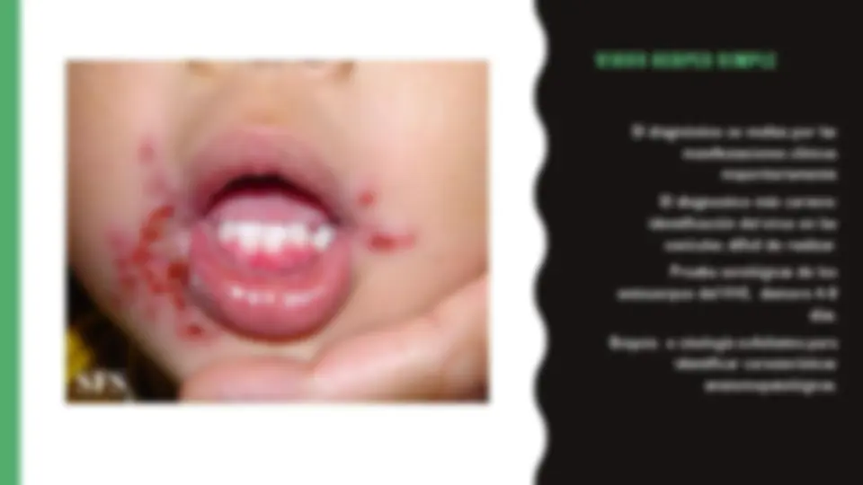 pfa