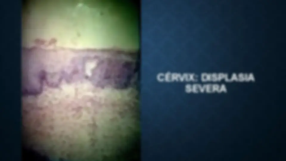 pf1f