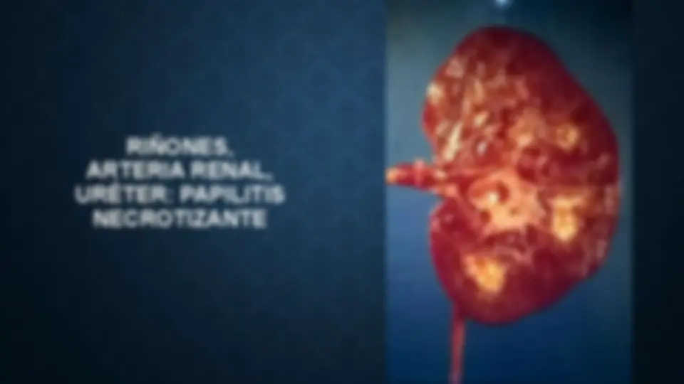pf5