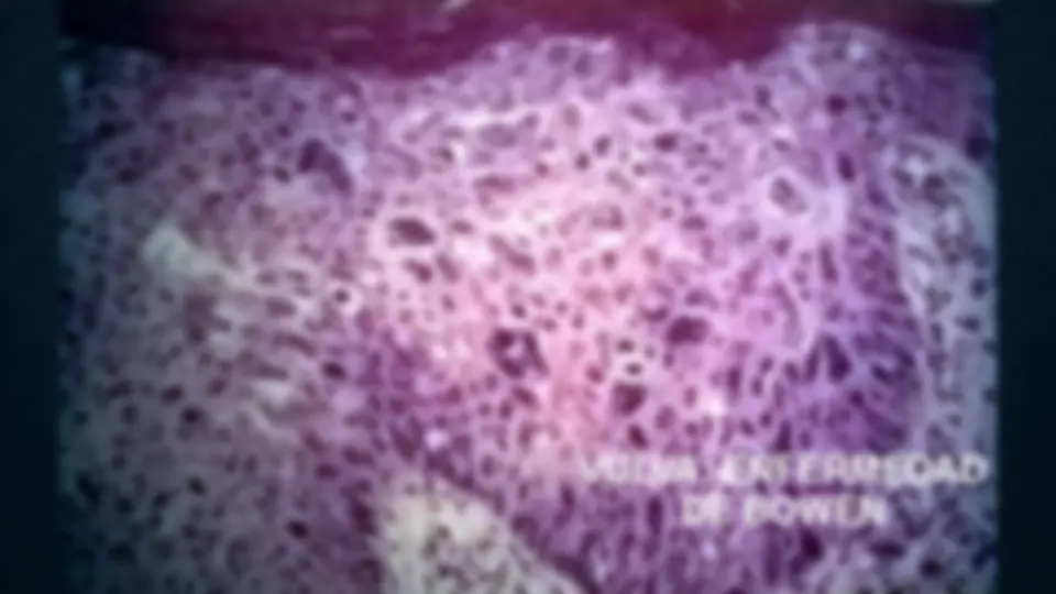 pf27