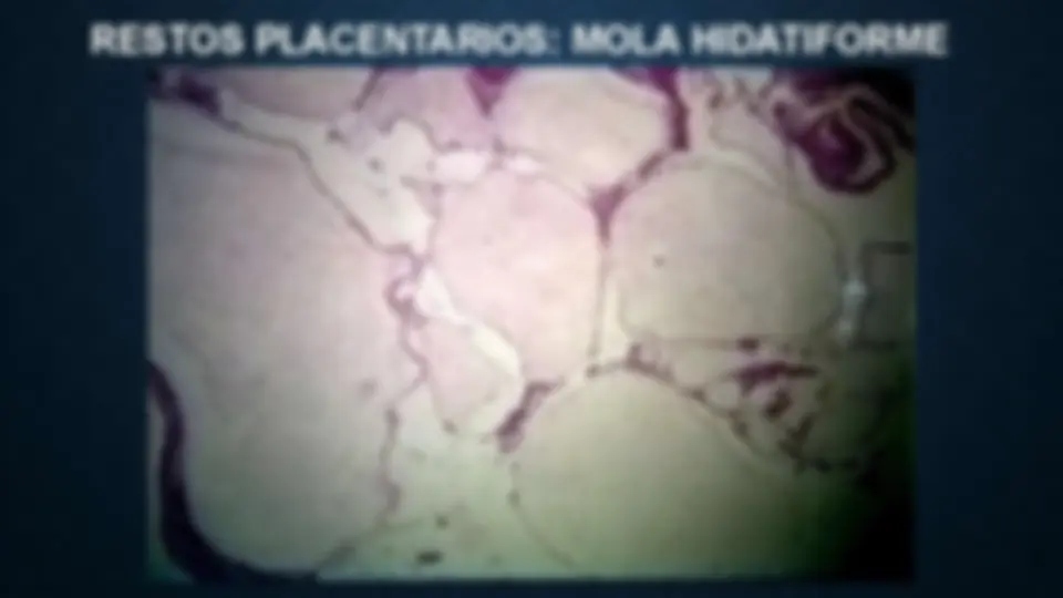 pf34