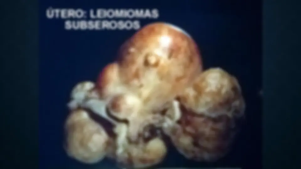 pf29