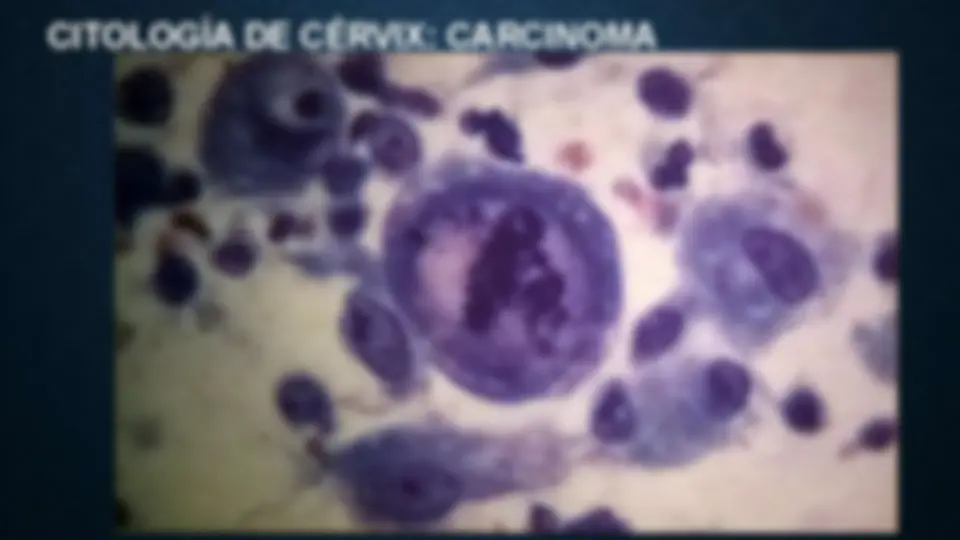 pf1c