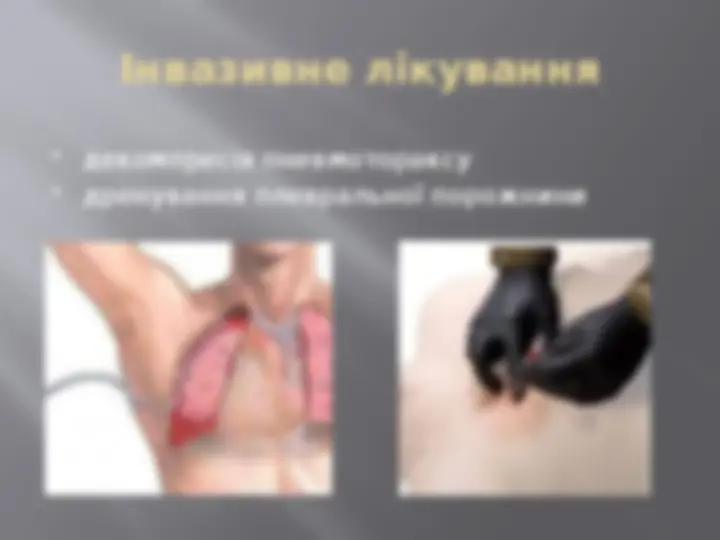 pfa