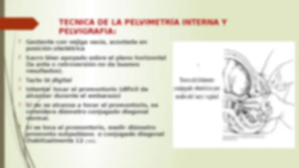 pf1b