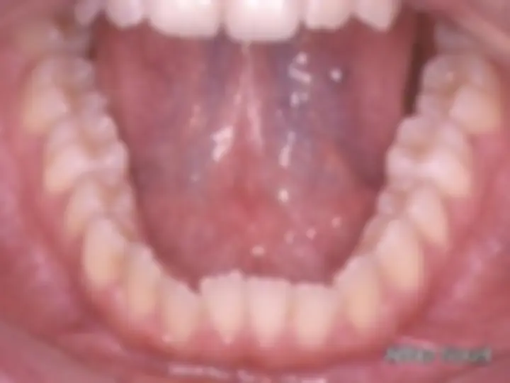 pf26