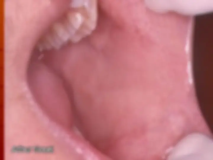 pf34