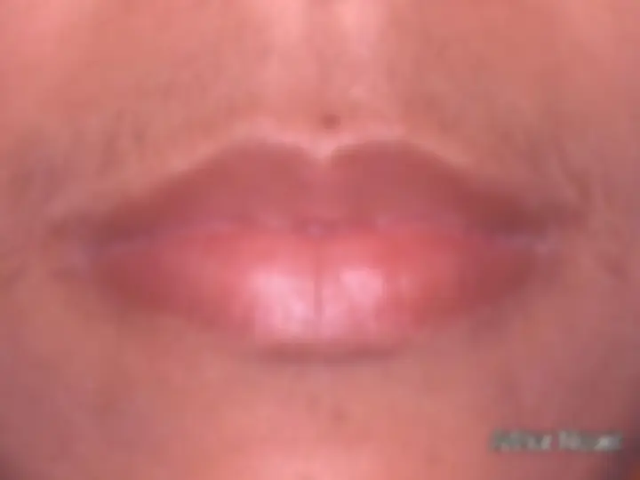 pf5