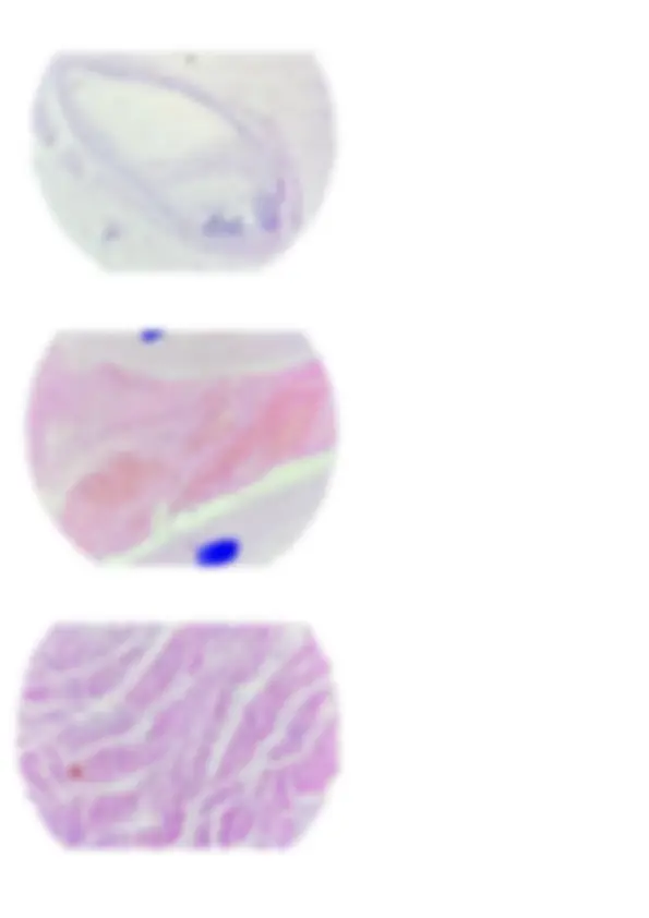 pf4