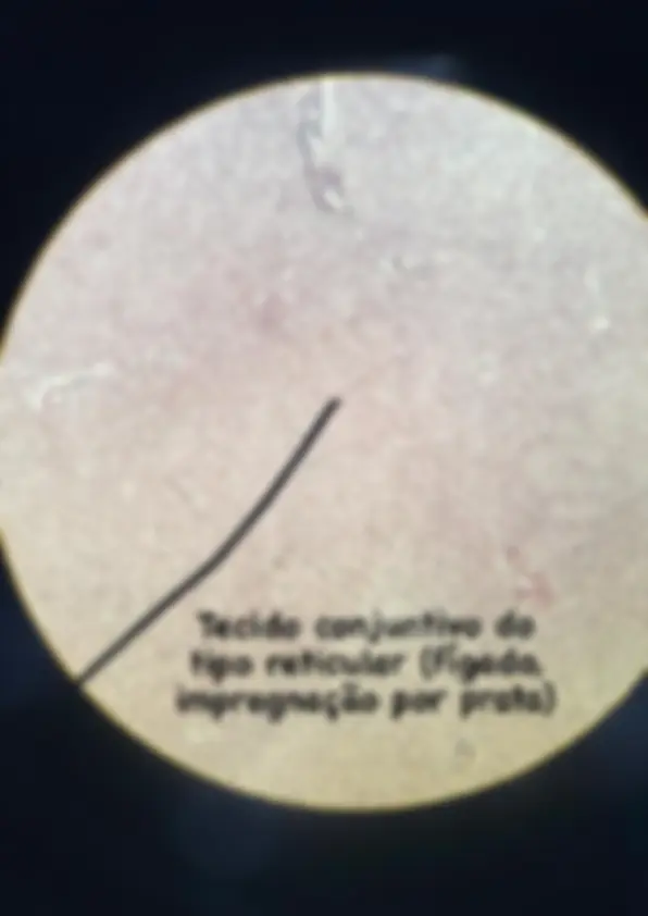pf1a
