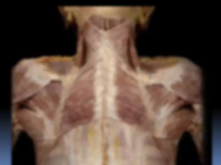 pf2a