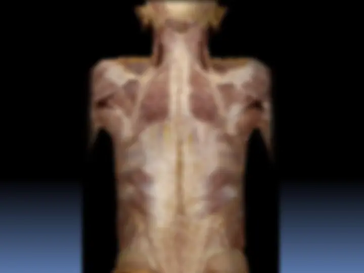 pf33