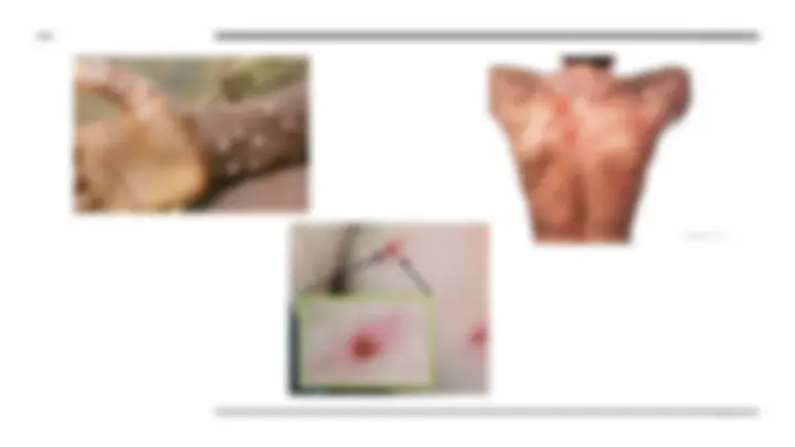 pf16
