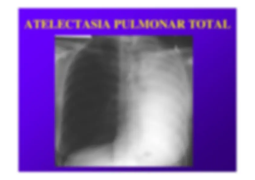 pf19