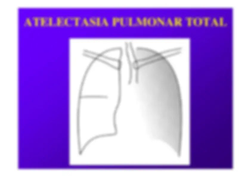 pf18