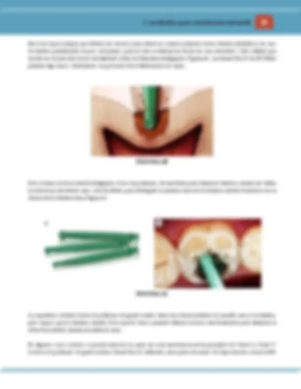 pf28