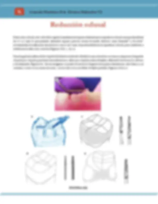 pf4d