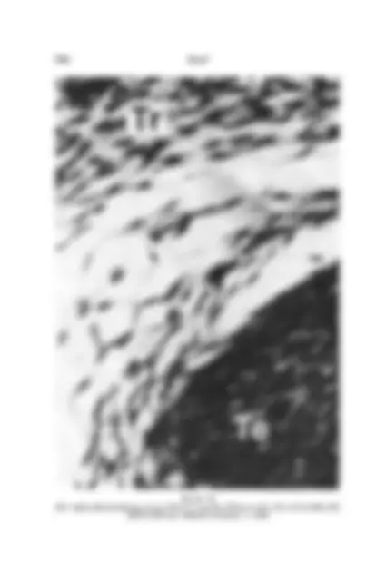 pf15