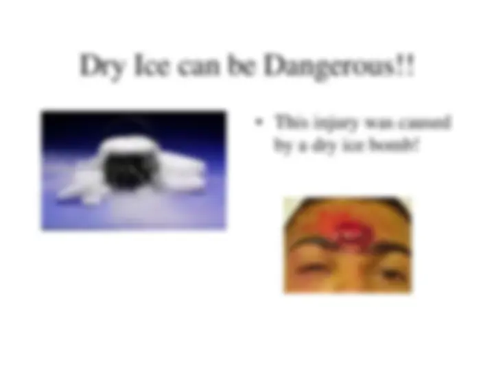 pfe