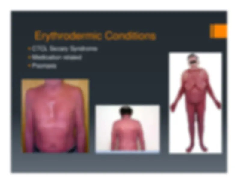 Description, Definition and Diagnosis of Common Skin Rashes | Summaries ...