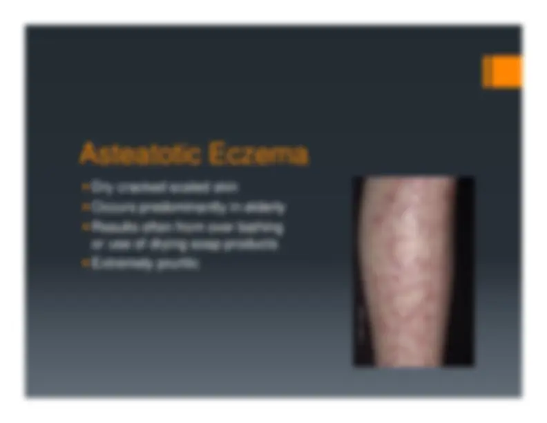 Description, Definition and Diagnosis of Common Skin Rashes | Summaries ...