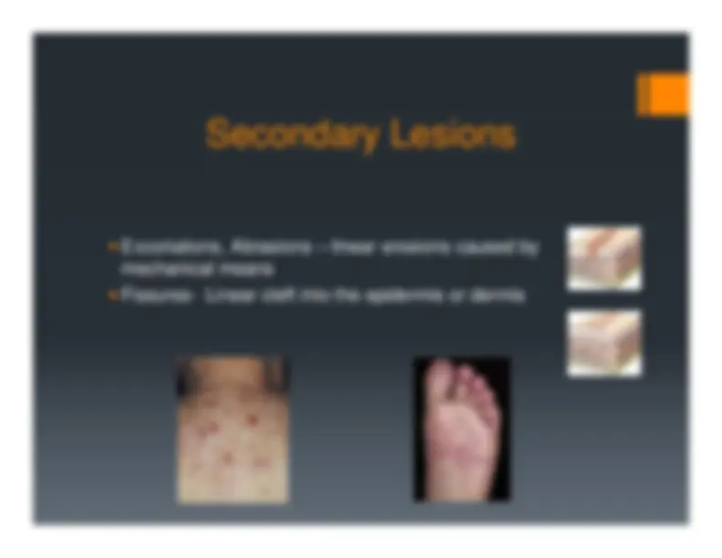 Skin Rashes Description First Aid Description, Definition and Diagnosis of Common Skin Rashes | Summaries ...